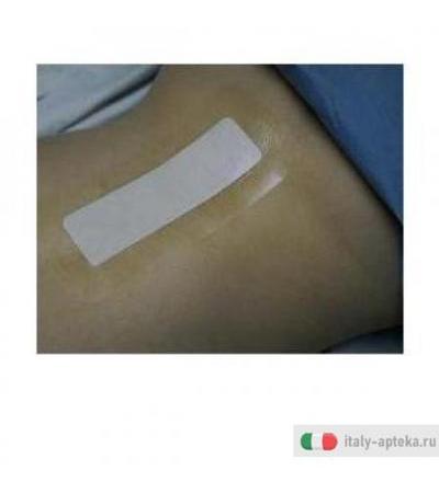 Tegaderm Cer+pad 5x7cm 5pz